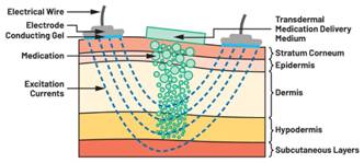  圖5.人體皮膚分層橫截面以及TMD和生物阻抗測量  考慮到生物阻抗分析的無創(chuàng)性，使用兩個(gè)金屬電極代表電氣傳感器，連接模擬前端(AFE)電路和患者皮膚。這個(gè)金屬與非金屬的接觸點(diǎn)是構(gòu)成整個(gè)電路的另一個(gè)關(guān)鍵部分，連接了AFE和人體電氣模型。電荷載體（電極中的電子和人體內(nèi)的離子）之間的相互作用可能對這些傳感器的性能產(chǎn)生重大影響，需要根據(jù)每種應(yīng)用進(jìn)行具體考慮。首先，金屬與離子溶液接觸的相互作用導(dǎo)致金屬表面附近溶液中離子濃度的局部變化。這種現(xiàn)象會(huì)改變電極下方區(qū)域的電荷中性，導(dǎo)致金屬周圍的電解質(zhì)電位與溶液其余部分不同，從而在金屬和電解質(zhì)主體之間產(chǎn)生一個(gè)電位差，即常說的“半電池電位”。其次，注入電流的直流分量會(huì)導(dǎo)致電極極化。  表1.各種電極類型和相應(yīng)的半電池電位  金屬及反應(yīng)  半電池電位(V)  Al → Al3+ + 3e- Al → Al3+ + 3e-  –1.706 –1.706  Ni → Ni2+ + 2e- Ni → Ni2+ + 2e-  –0.230 -0.230  H2 → 2H+ + 2e- H2 → 2H+ + 2e-  0.000 (by definition) 0.000（根據(jù)定義）  Ag + Cl- → AgCl + e- Ag + Cl- → AgCl + e-  +0.223 +0.223  Ag → Ag+ + e- Ag → Ag+ + e-  +0.799 +0.799  Au → Au+ + e- Au → Au+ + e-  +1.680 +1.680  這是一種不良現(xiàn)象，往往導(dǎo)致電極性能下降。這些考量表明，電極也需要定義適當(dāng)?shù)碾姎饽Ｐ停▍⒁妶D6）。我們可以將干電極表示為具有三個(gè)串聯(lián)元件的電路：一個(gè)用于模擬半電池電位(EHC)的直流電源；一個(gè)用于模擬金屬和非金屬（人體）之間接觸的RC并聯(lián)電池(Rd||Cd)；以及一個(gè)用于模擬電極金屬的電阻Rs。